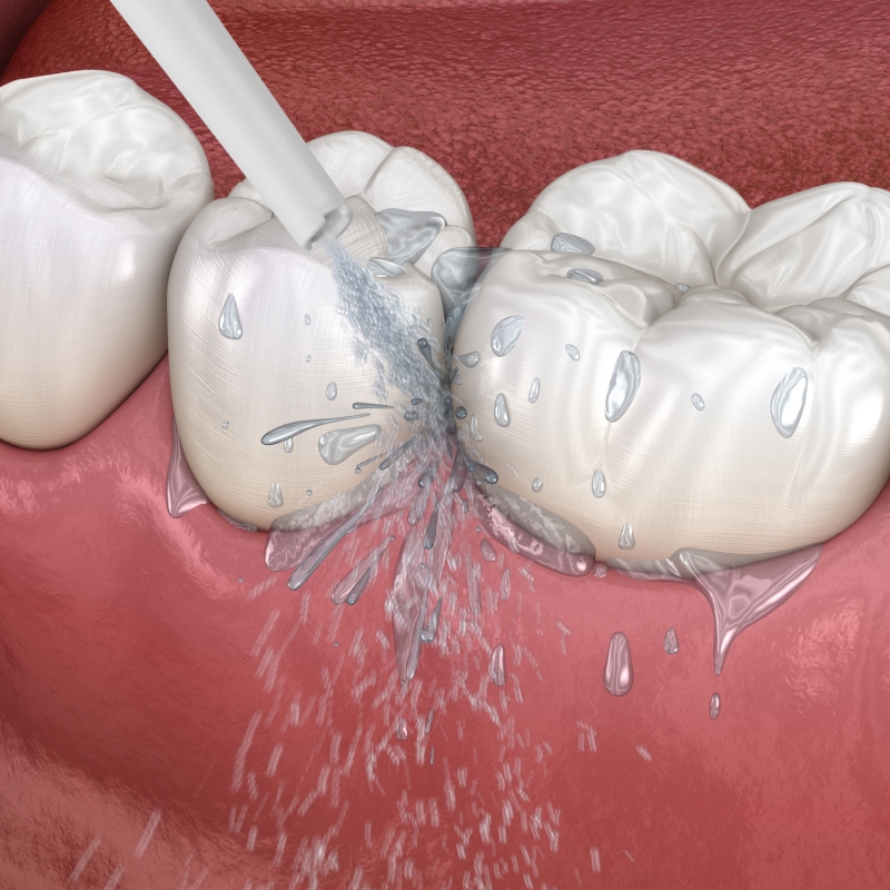 Zobna prha Lanaform Hydrojet