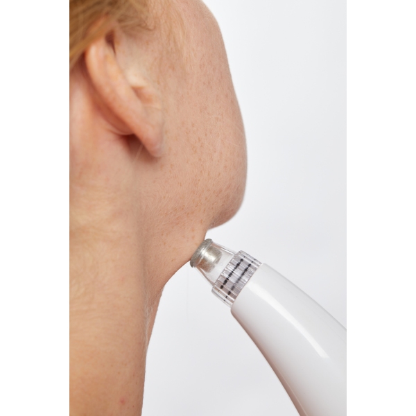 Naprava za odstranjevanje ogrcev in čiščenje obraza Lanaform Limpia