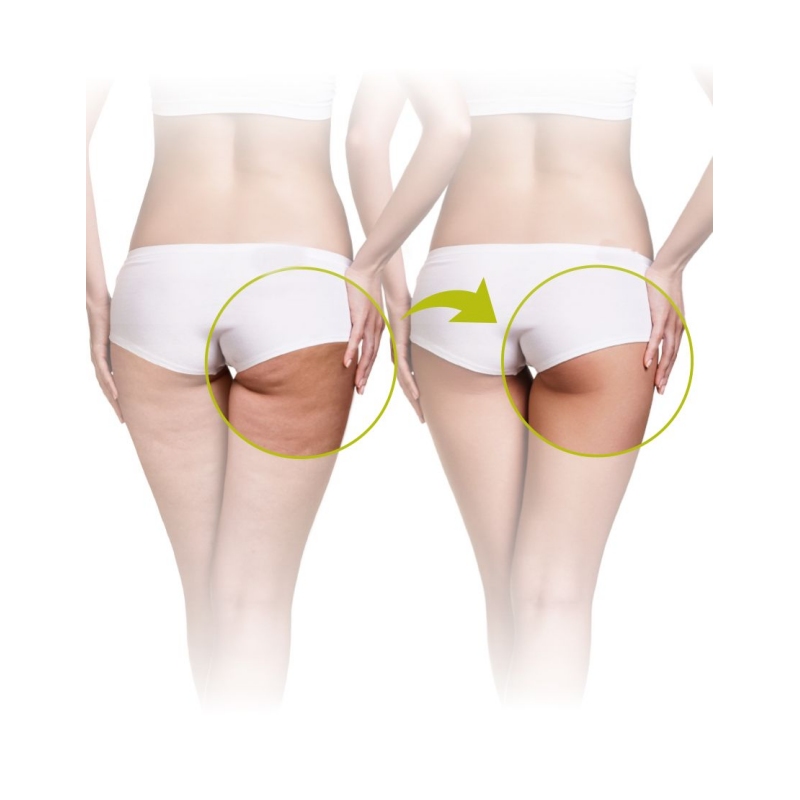 Masažna naprava Lanaform Skin Mass Grey